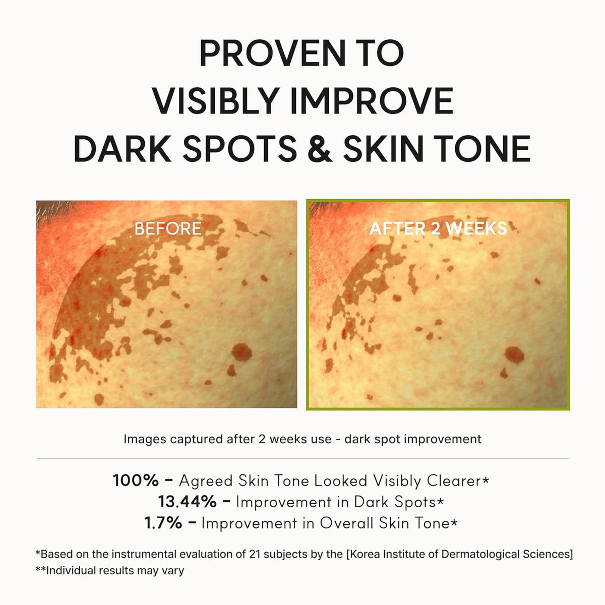 Radiance Boost Serum